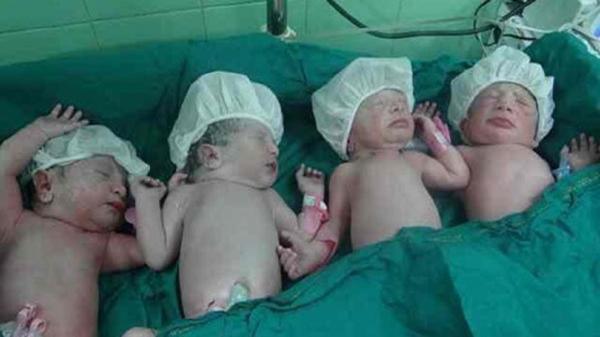 تولد چهارقلو های عجول در یزد